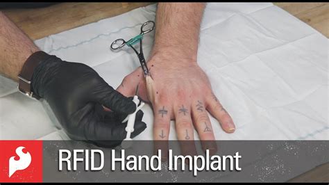 rfid implants for sale